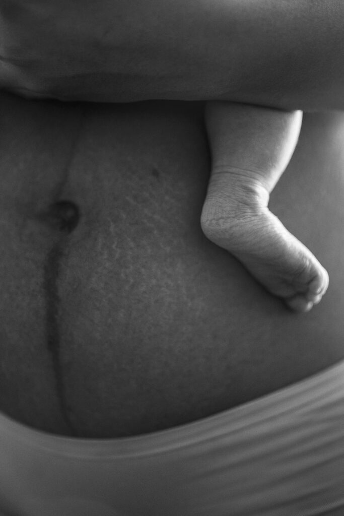postpartum